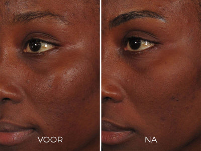 Image Skincare ILUMA - Intense Facial Illuminator 30 ml