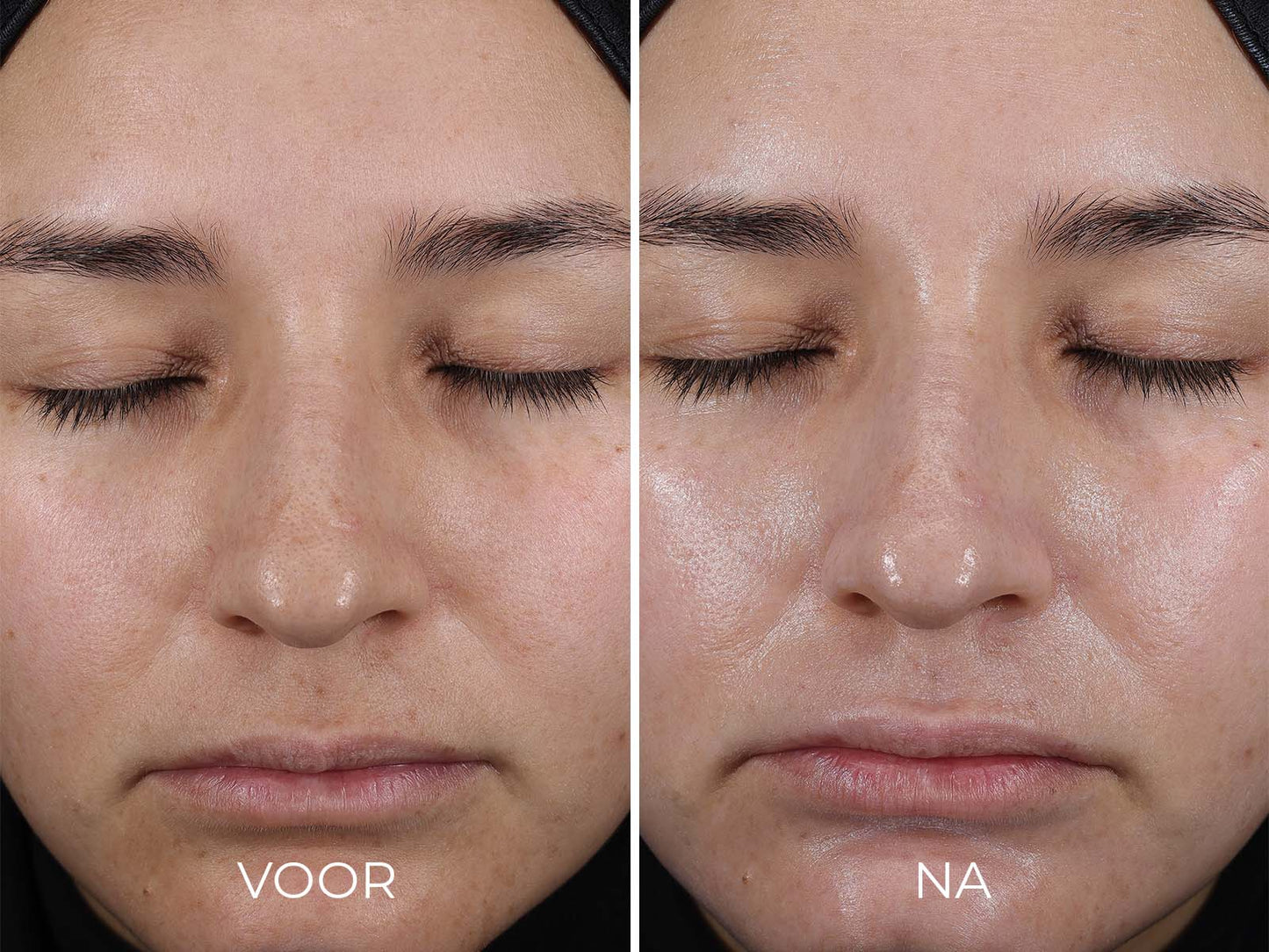 Image Skincare Daily PREVENTION Pure Mineral Hydrating Moisturizer 30 SPF 73 gr