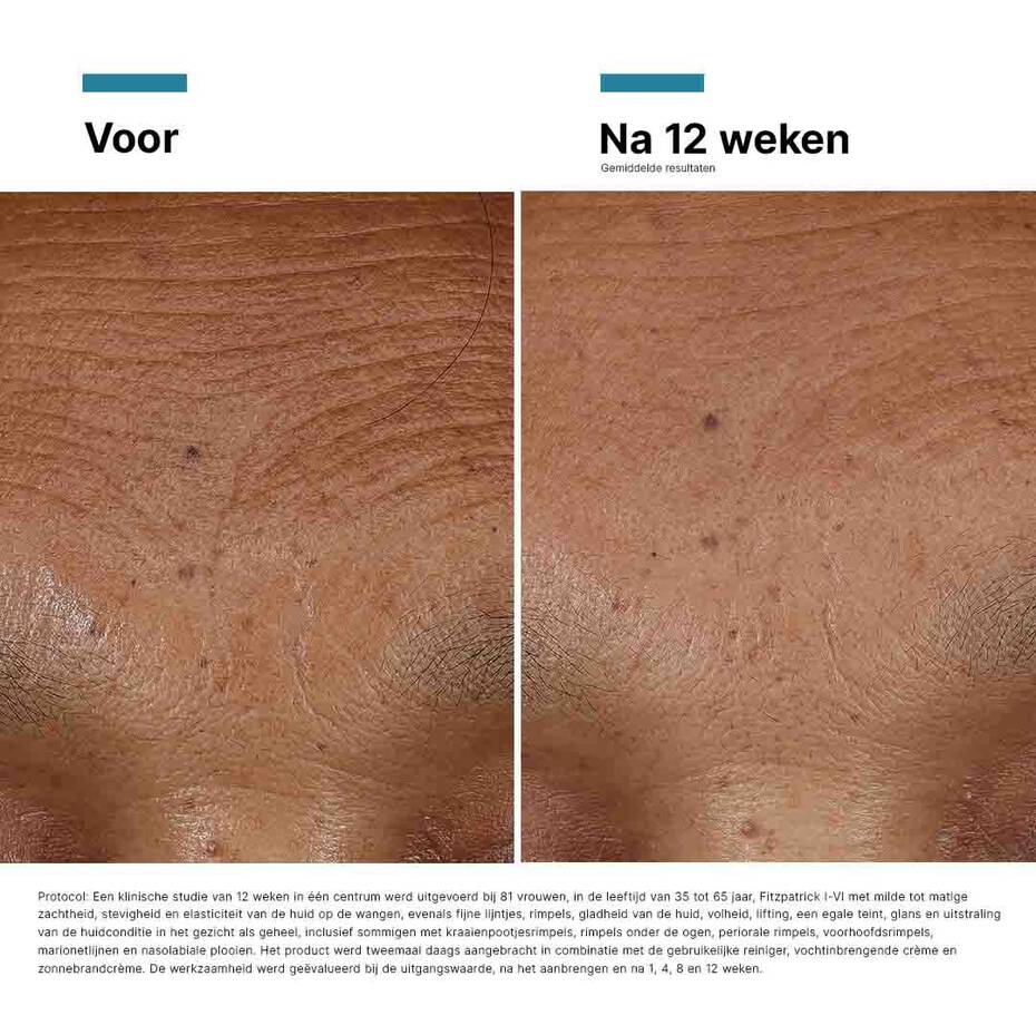 SkinCeuticals HA Intensifier MULTI-GLYCAN 30 ml