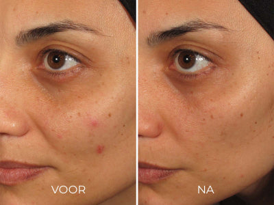 Image Skincare ILUMA - Intense Facial Illuminator 30 ml