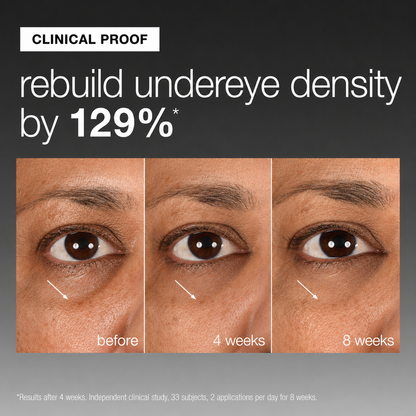 Demalogica Smart Eye Density Undereye Serum