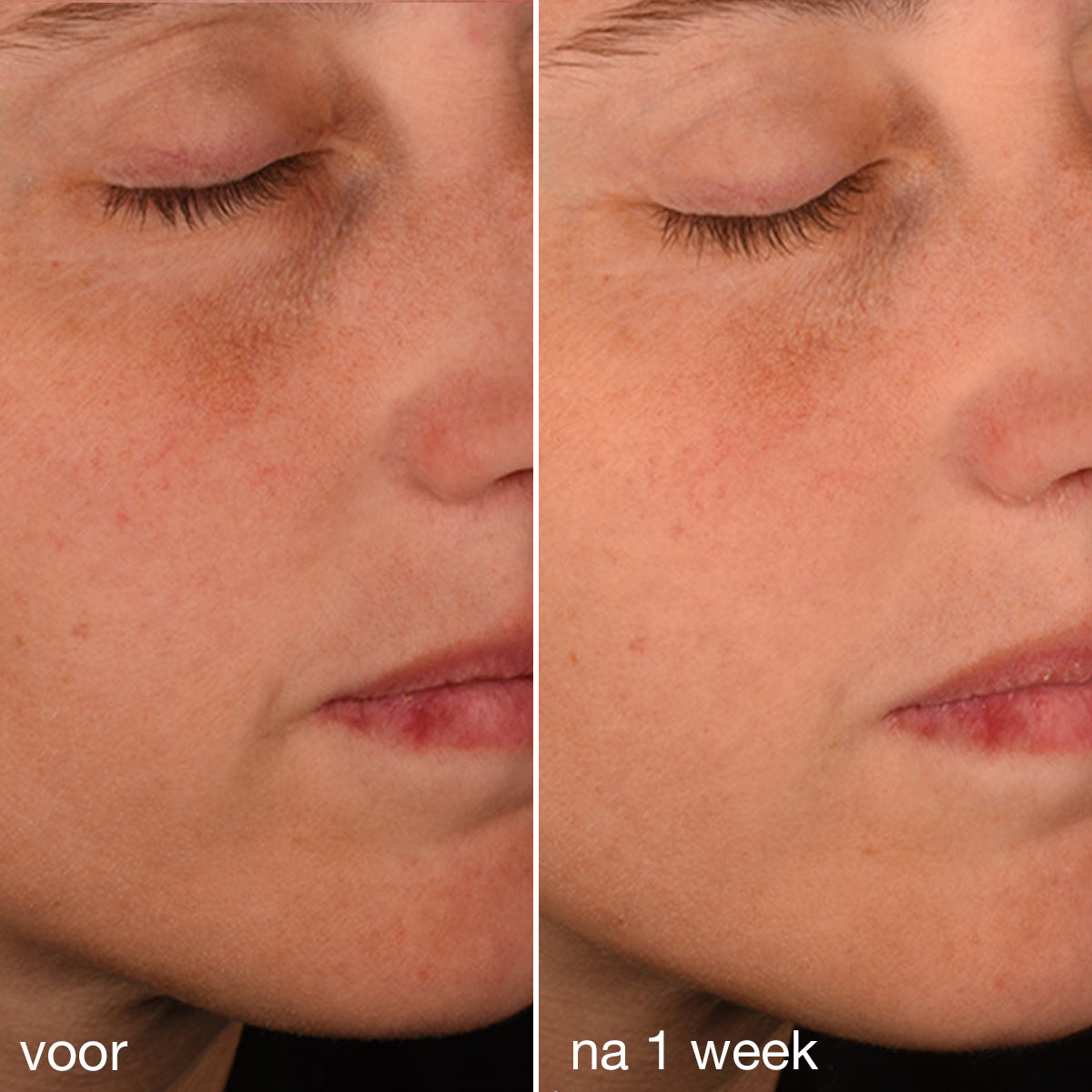 Dermalogica Pro-Collagen Banking Serum