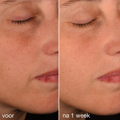 Dermalogica Pro-Collagen Banking Serum