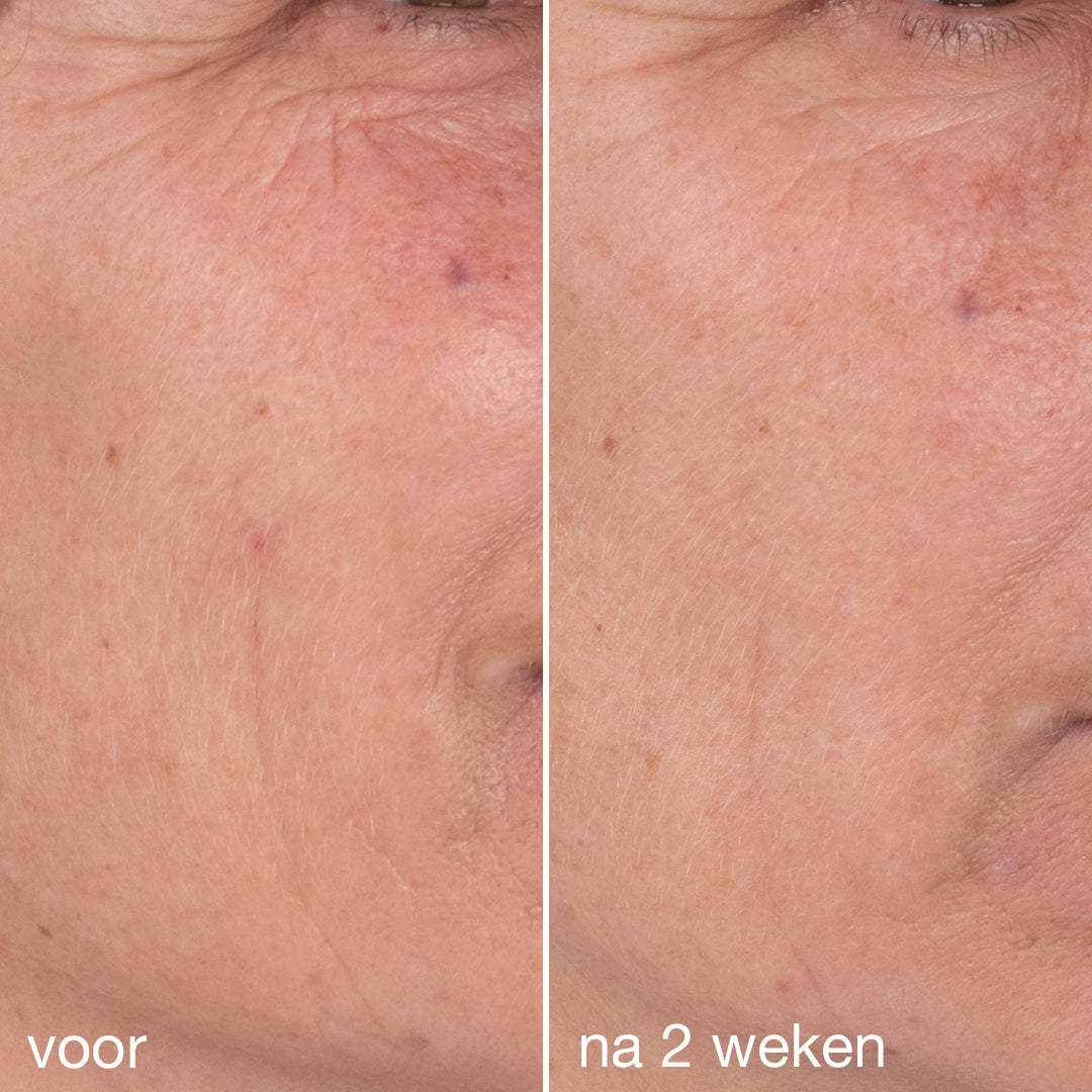 Dermalogica Dynamic Skin Retinol Serum