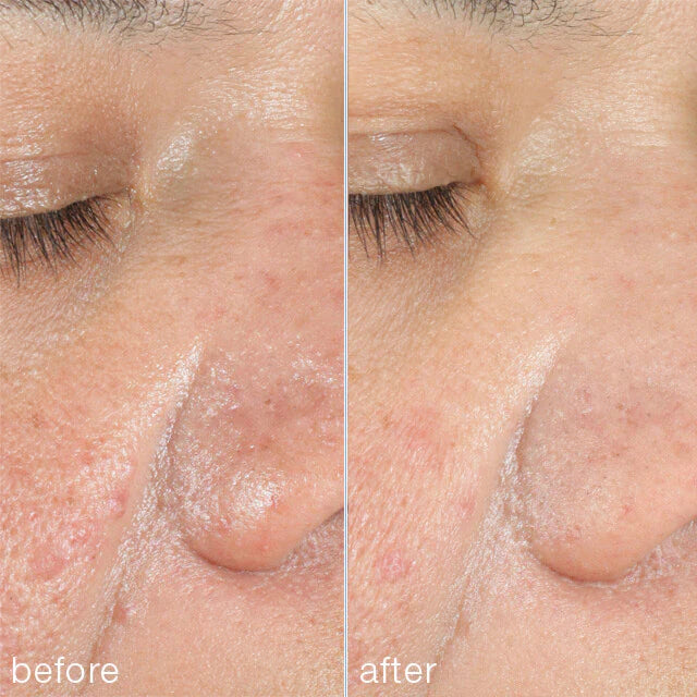 Dermalogica PowerBright Dark Spot Peel