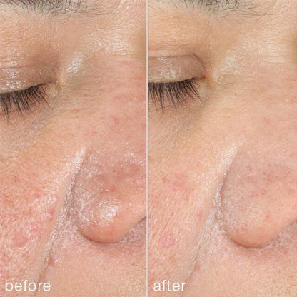 Dermalogica PowerBright Dark Spot Peel