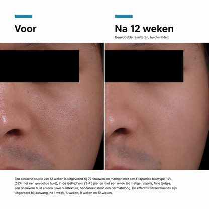 SkinCeuticals P-TIOX Anti-Wrinkle Cream 48 ml
